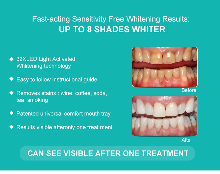 Newest 32LED Rechargeable Teeth Whitening kit-